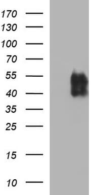 CD274 / B7-H1 / PD-L1 Antibody (clone OTI2C7, Carrier-free)
