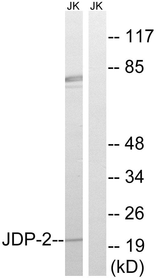 JUNDM2 / JDP2 Antibody (p148)