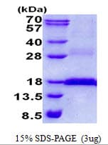 Human CD3E Protein (Recombinant His)