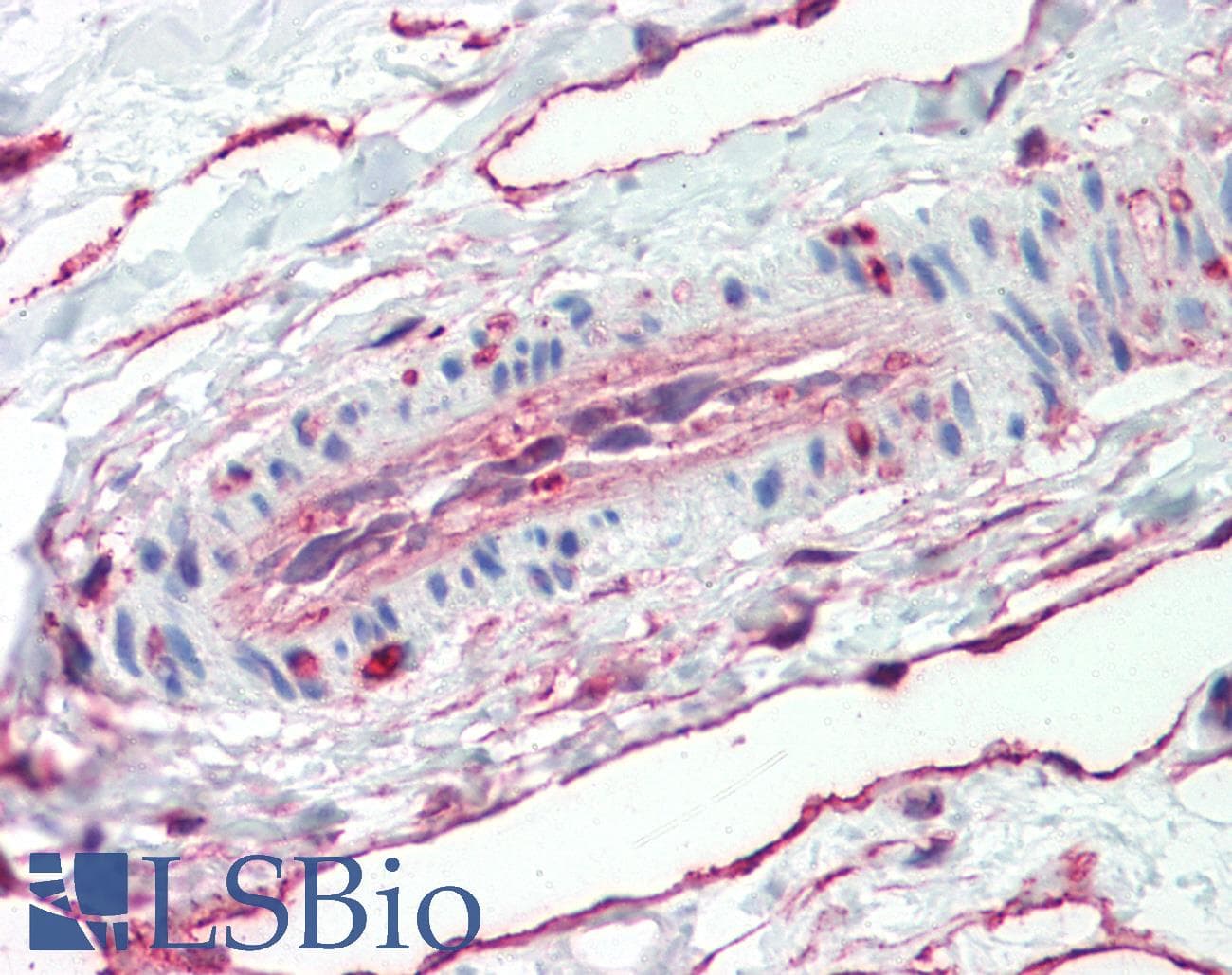 IHC-plus™ ANXA5 / Annexin V Antibody (C-Terminus)