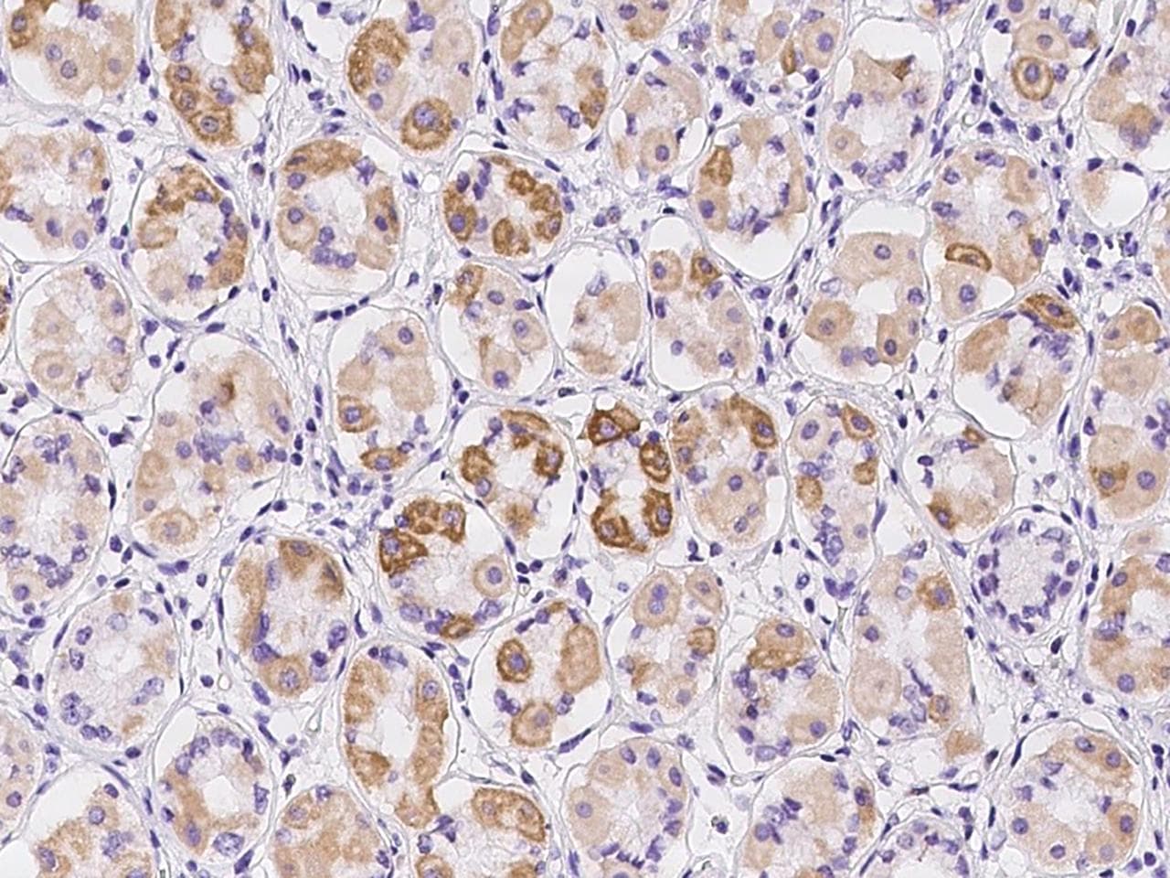 Polyclonal Rabbit anti-Human NDUFB9 Antibody (IHC)