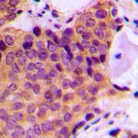 JNK1+2+3 Antibody (phospho-Thr183)