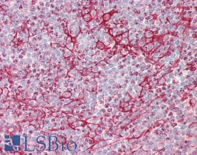 IHC-plus™ ITPR3 Antibody (aa1755-1825)
