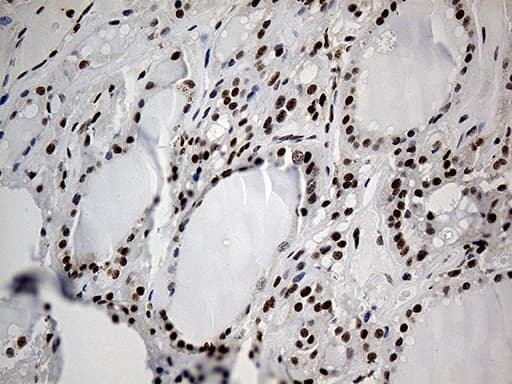 ELL / MEN Antibody (aa302-621, clone OTI1G2)