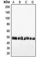 Polyclonal Rabbit anti-Human VASP Antibody (Internal, IHC, IF, WB)