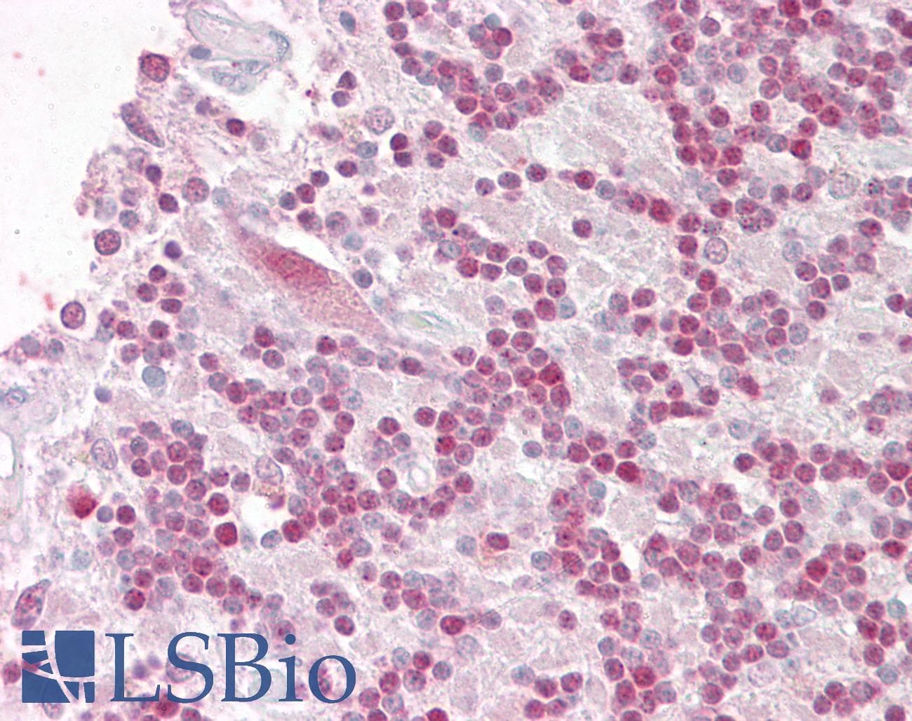 IHC-plus™ TRIM69 / Trif Antibody (aa329-341)