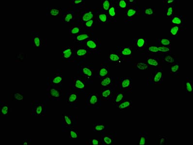 Recombinant Monoclonal Rabbit anti-Human HIST1H4I Antibody (IF, WB)