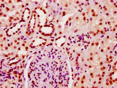 HIST1H2BN Antibody