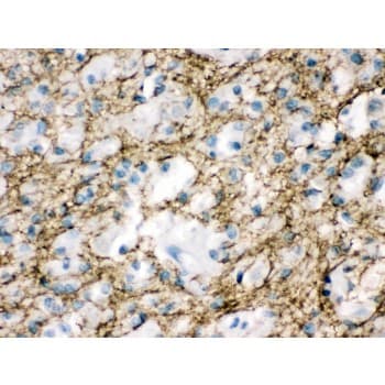 STXBP1 / MUNC18-1 Antibody (aa184-216)