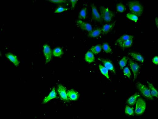 TPM3 Antibody