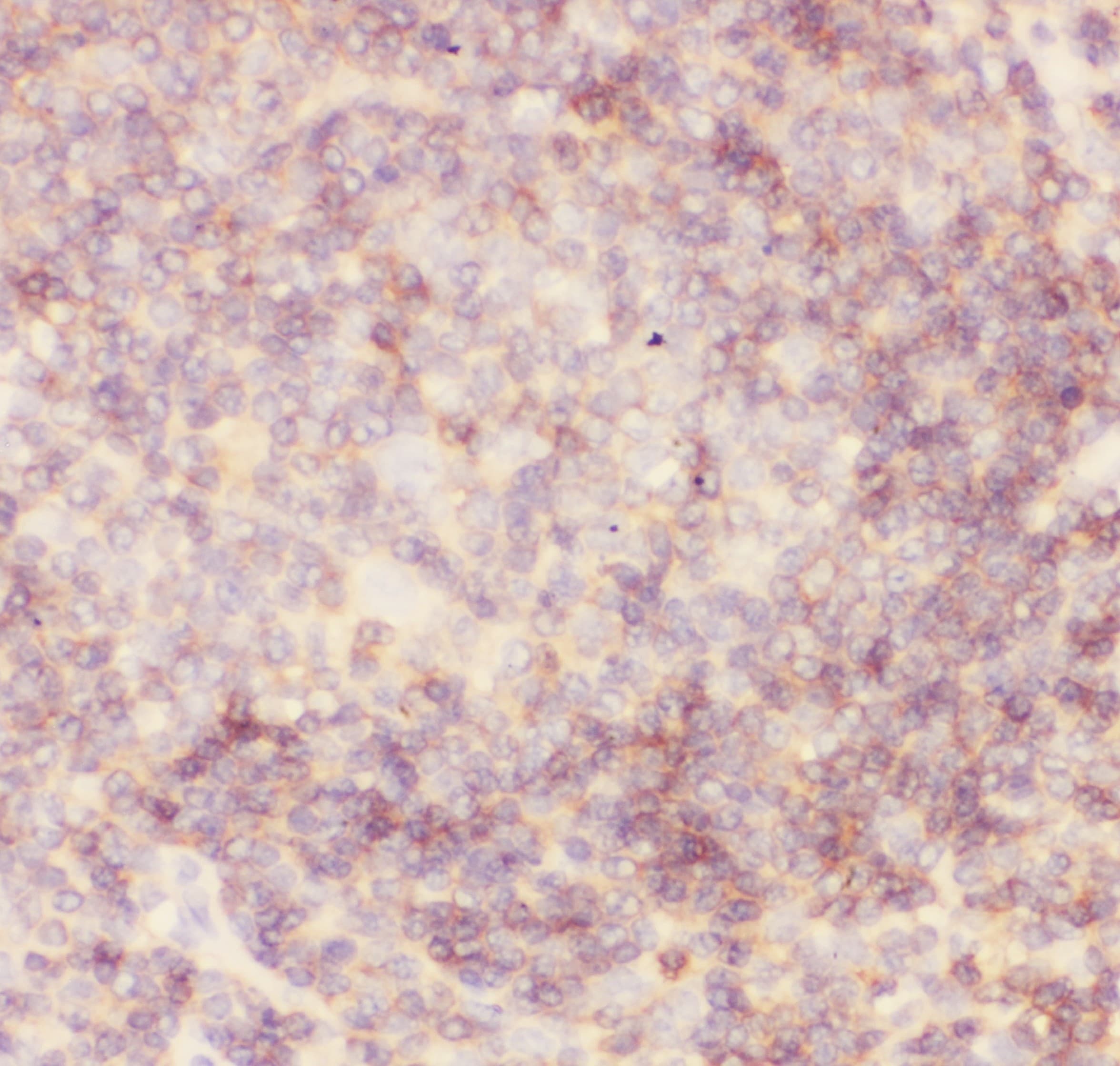 Polyclonal Rabbit anti-Human CD45 / LCA Antibody (aa1113-1304, IHC, WB)