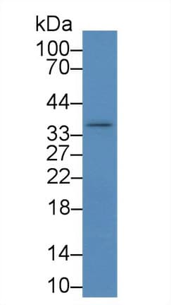 IKBIP Antibody (aa80-315)