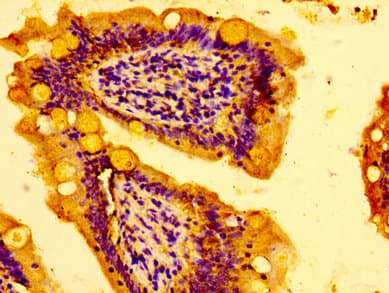 AZI2 / NAP1 Antibody