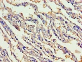 GIF / Intrinsic Factor Antibody (aa19-417)