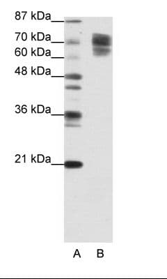 PathPlus™ CTNNB1 / Beta Catenin Antibody (C-Terminus)