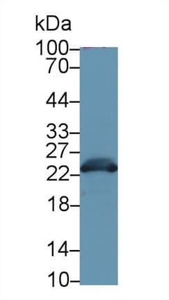 GSTA3 Antibody (aa1-221, Cy3)