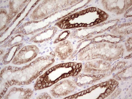 ABCB1 / MDR1 / P Glycoprotein Antibody (aa995-1280, clone OTI8A9)