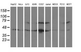 RAP74 / GTF2F1 Antibody (clone OTI2H3)