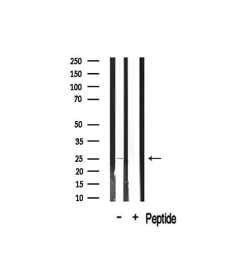 Polyclonal Rabbit anti-Human CLDN2 / Claudin 2 Antibody (IHC, IF, WB)