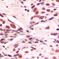 LMX1B Antibody (Internal)