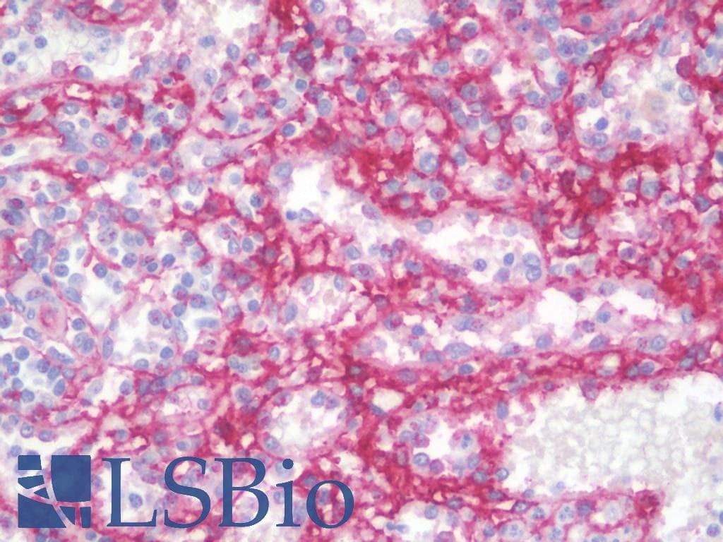 PathPlus™ CD105 Antibody (clone 8A1)