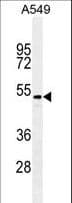 TGFB2 / TGF Beta2 Antibody