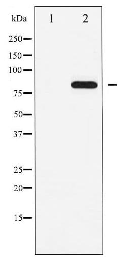 STAT5A Antibody (phospho-Tyr694)