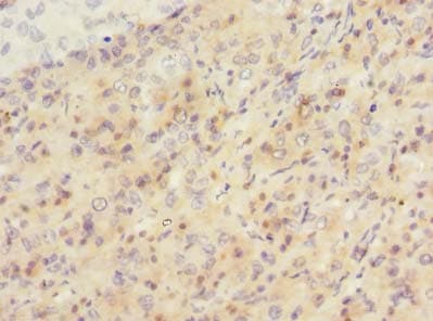 Polyclonal Rabbit anti-Human SIPA1L2 Antibody (IHC)