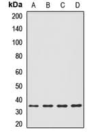 IL20RB Antibody