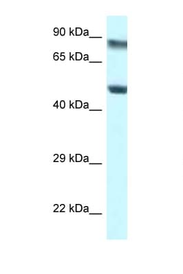 PUS1 Antibody (aa88-137)
