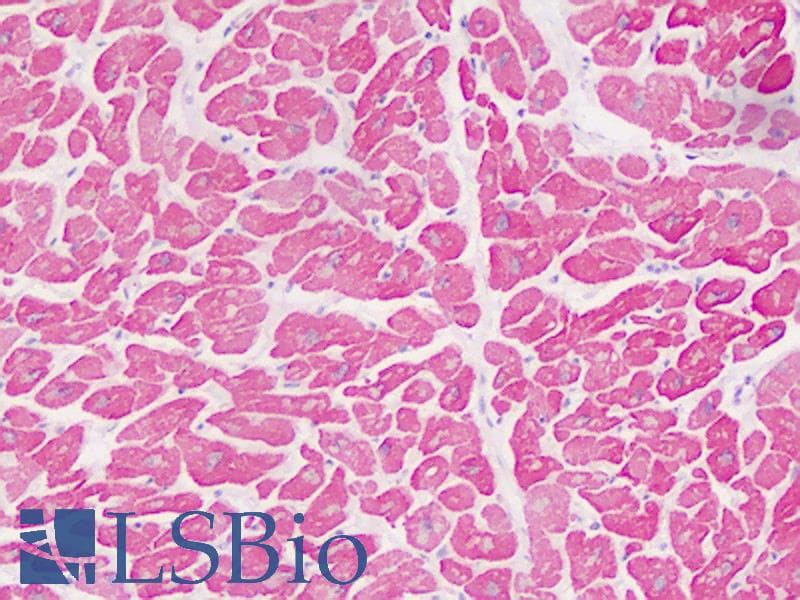 IHC-plus™ DAAM1 Antibody (aa45-74)