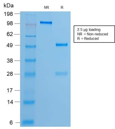ER Alpha / Estrogen Receptor Antibody (clone ESR1/2299R, Azide-free, Carrier-free)