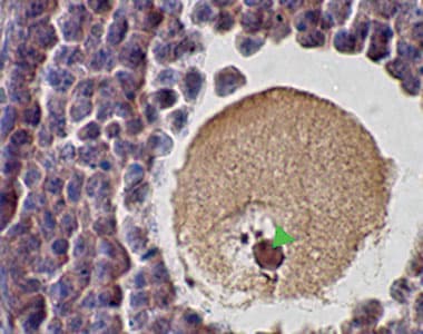 SCP1 / SYCP1 Antibody (C-Terminus)