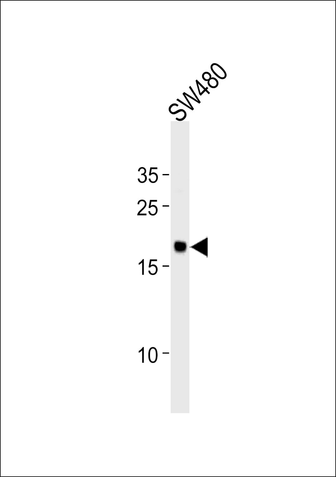 RPL29 / Ribosomal Protein L29 Antibody (aa71-98)