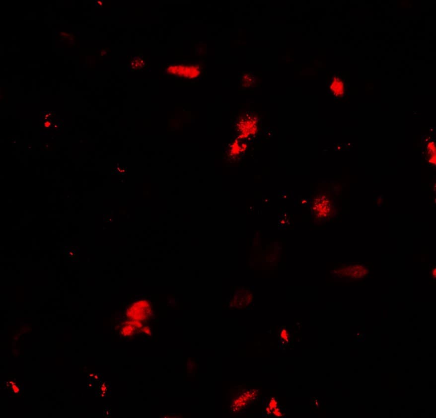 IHC-plus™ GRK6 Antibody