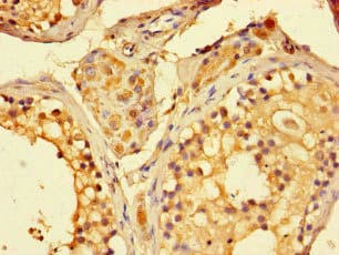 SIRT1 / Sirtuin 1 Antibody