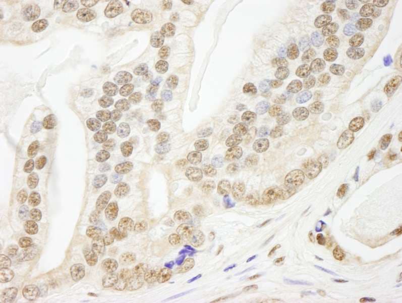 PDS5B / AS3 Antibody (aa1200-1250)