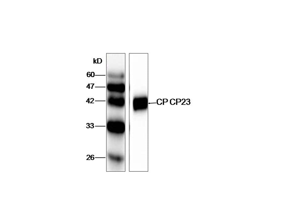 Cryptosporidium Immunodominant Antigen Cp23 Antibody (clone BU-33)