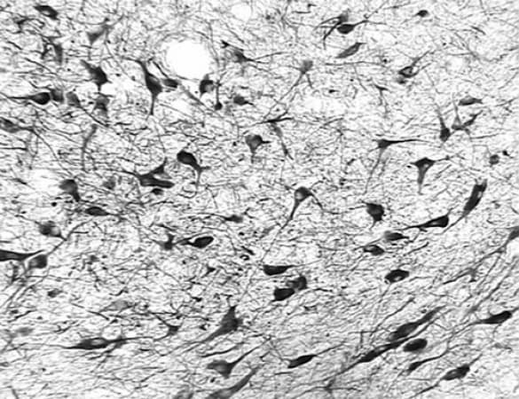 OGG1 Antibody (aa1-100, DY488)