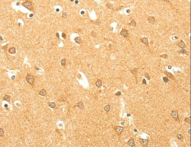 Polyclonal Rabbit anti-Human AARS2 Antibody (IHC, WB)
