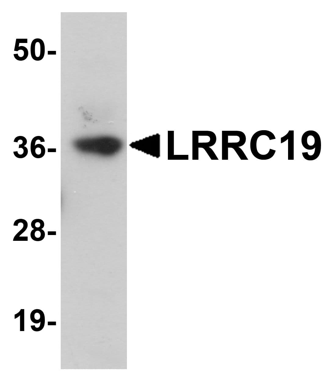 IHC-plus™ Polyclonal Rabbit anti-Human LRRC19 Antibody (IHC, IF, WB)