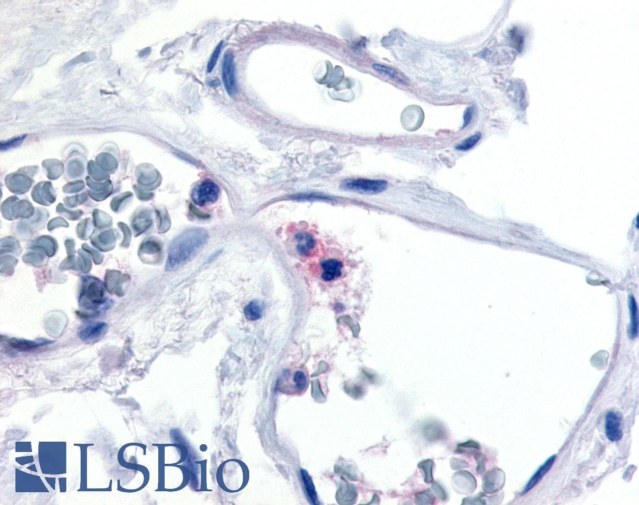 PathPlus™ ITGAX / CD11c Antibody (Internal)