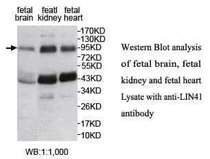 LIN41 / TRIM71 Antibody (N-Terminus)