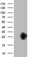ZFAND2B Antibody (clone OTI3A2)