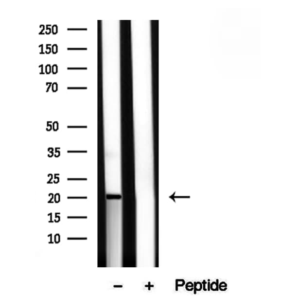 Polyclonal Rabbit anti-Human TIMM22 Antibody (IHC, IF, WB)