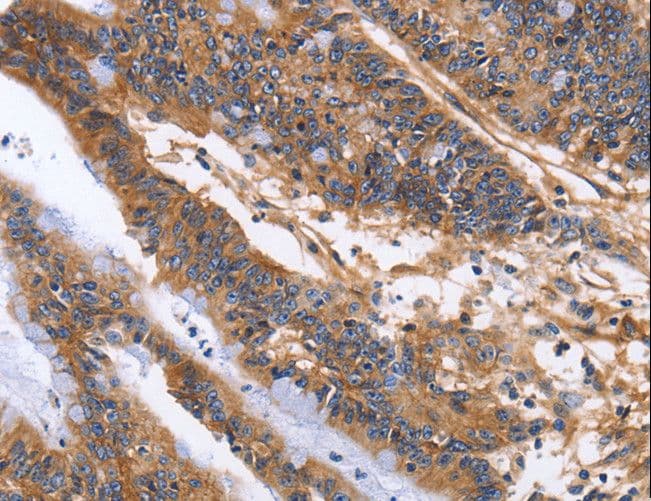 ITGB1 / Integrin Beta 1 / CD29 Antibody