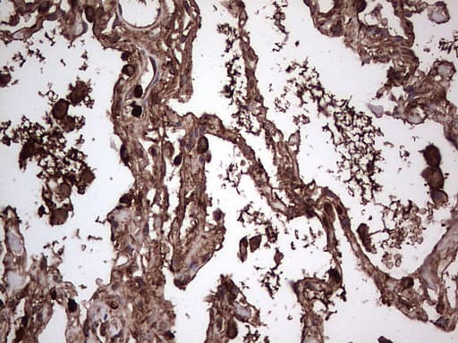 PKM2 Antibody (clone 1G10)