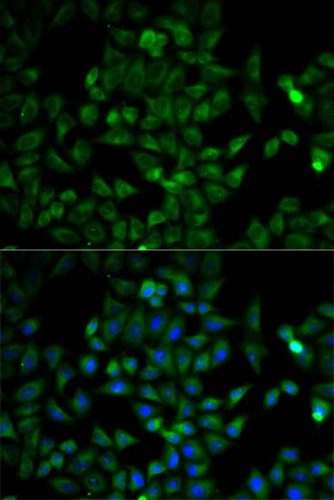 IHC-plus™ Polyclonal Rabbit anti-Human TPI1 / TPI Antibody (IHC, IF, WB)