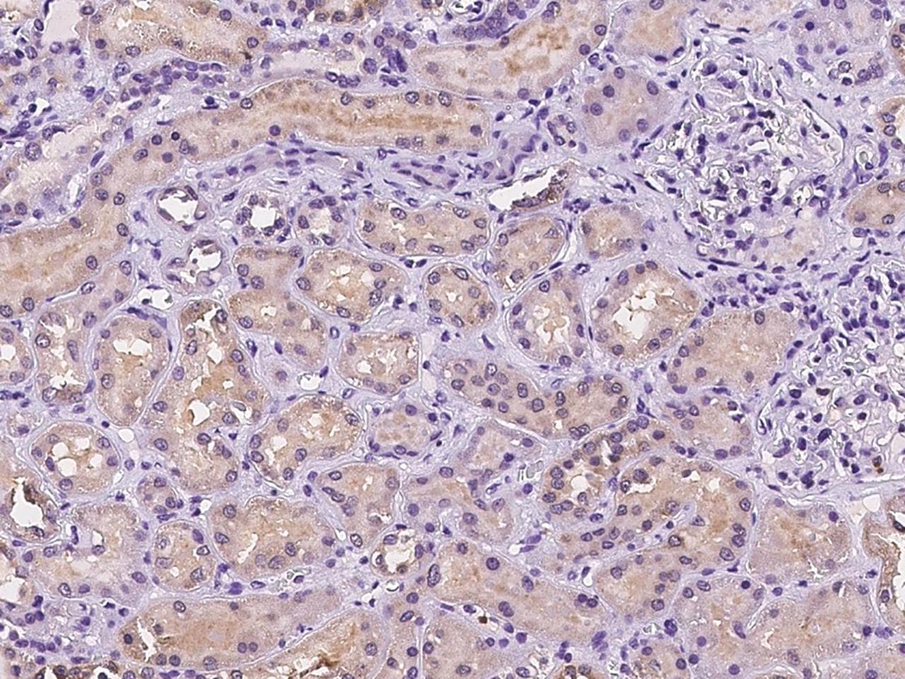 Polyclonal Rabbit anti-Human CNIH1 / CNIH Antibody (IHC)