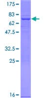 Human PAFAH2 Protein (Recombinant GST)